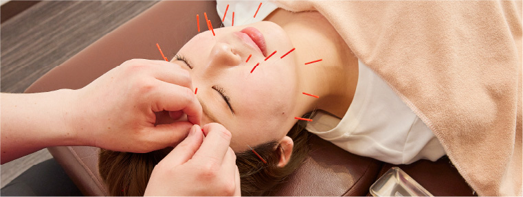 美容鍼ページへ 美容鍼の施術イメージ