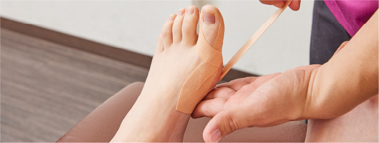 外反母趾ページへ 外反母趾の施術イメージ